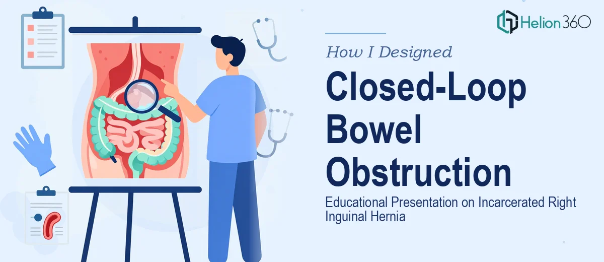How I Designed a Comprehensive Educational Presentation on Closed-Loop Bowel Obstruction in Incarcerated Right Inguinal Hernia